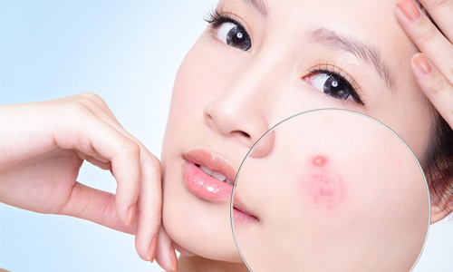 Dược mĩ phẩm hỗ trợ điều trị da hiệu quả