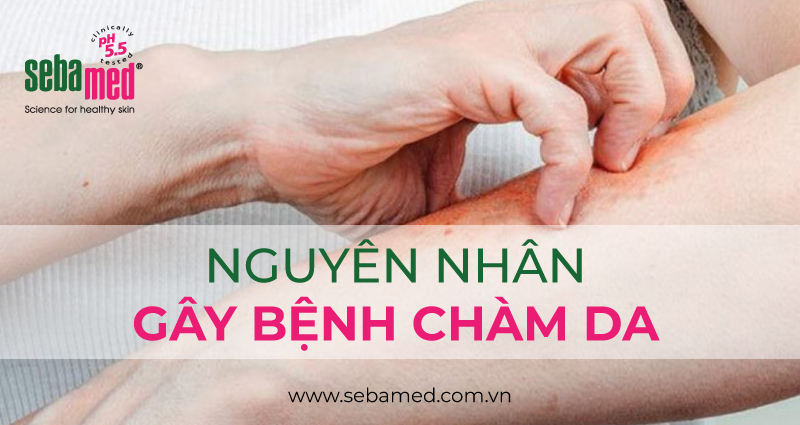 chàm da