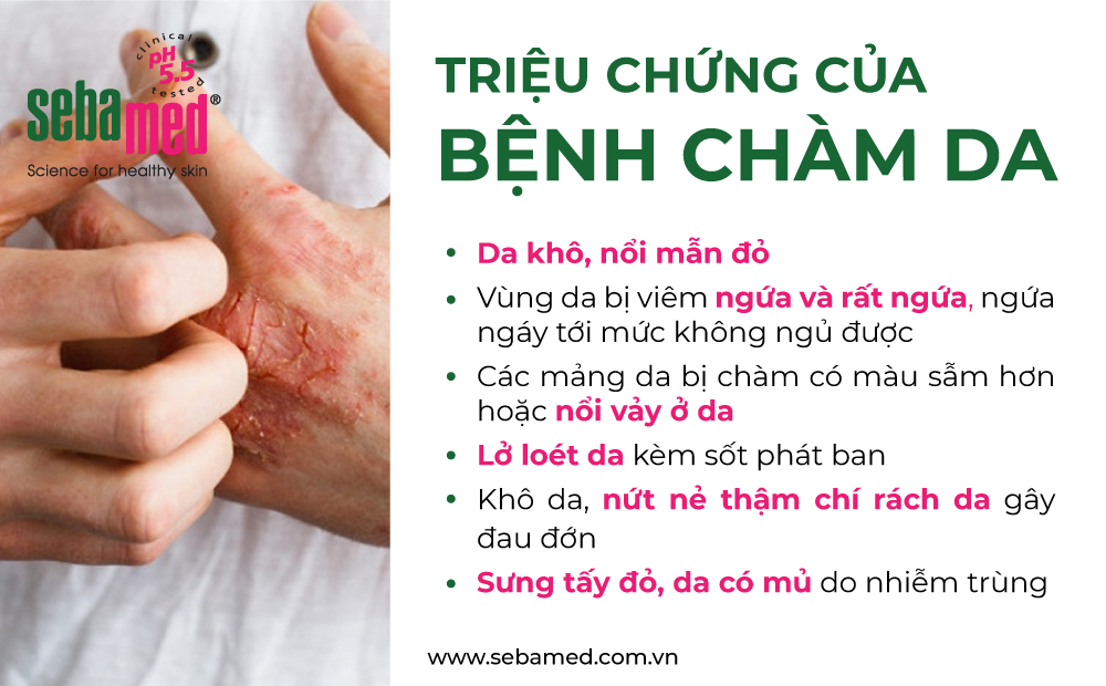 Bệnh chàm da và tầm quan trọng của ph5. 5 - 1 - sebamed Bệnh chàm