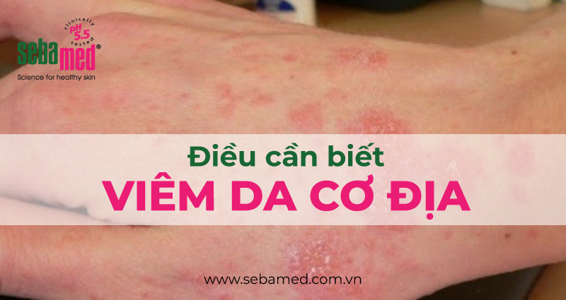 viem da co dia va nhung dieu can biet sebamed - 3
