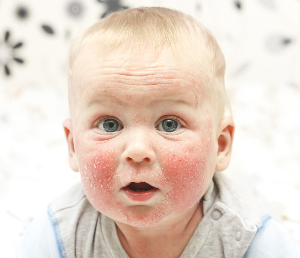 cham sua baby - 1