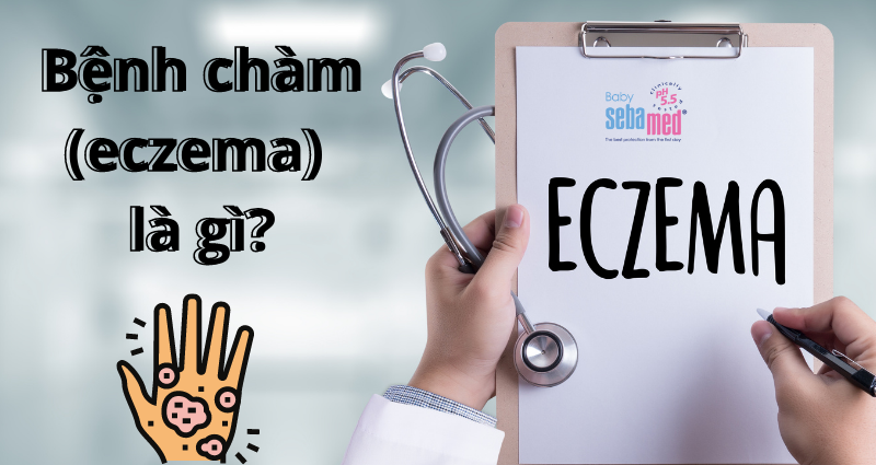 Bệnh chàm là gì ?