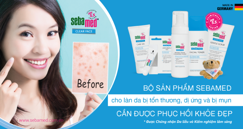 5 bước trị mụn hiệu quả từ Sebamed – www.sebamed.com.vn