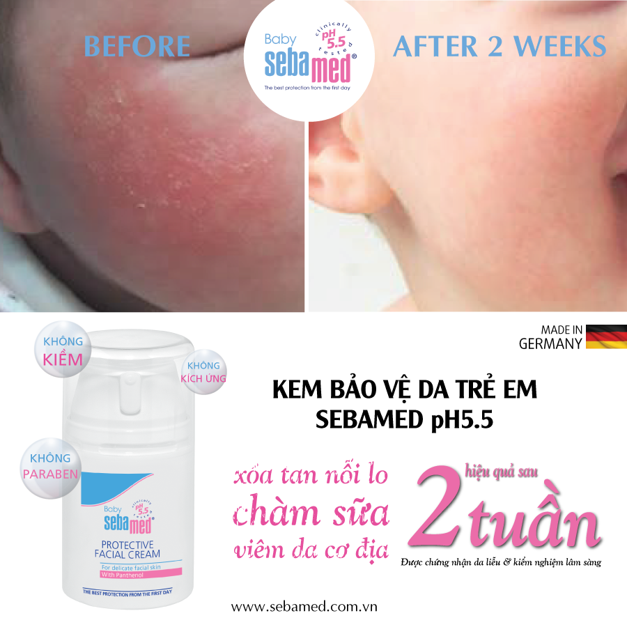 before after kem bao ve da em be sebamed pH5 5 - 2