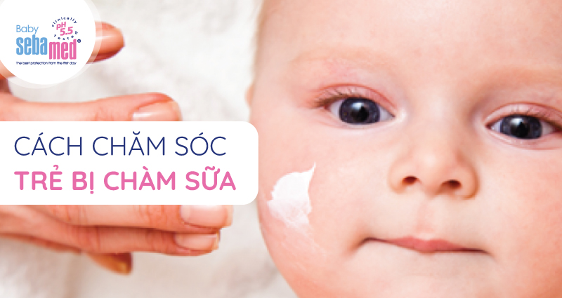 Cách chăm sóc trẻ bị chàm sữa