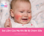 Sai Lầm Của Mẹ Khi Bé Bị Chàm Sữa