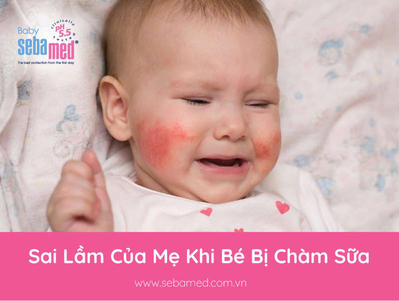 Sai Lầm Của Mẹ Khi Bé Bị Chàm Sữa