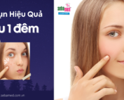 Cách Trị Mụn Hiệu Quả Nhanh Nhất Sau 1 Đêm