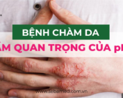 bệnh chàm da