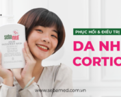 Điều trị da nhiễm corticoid