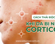 Da nhiễm corticoid