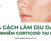 Da nhiễm corticoid