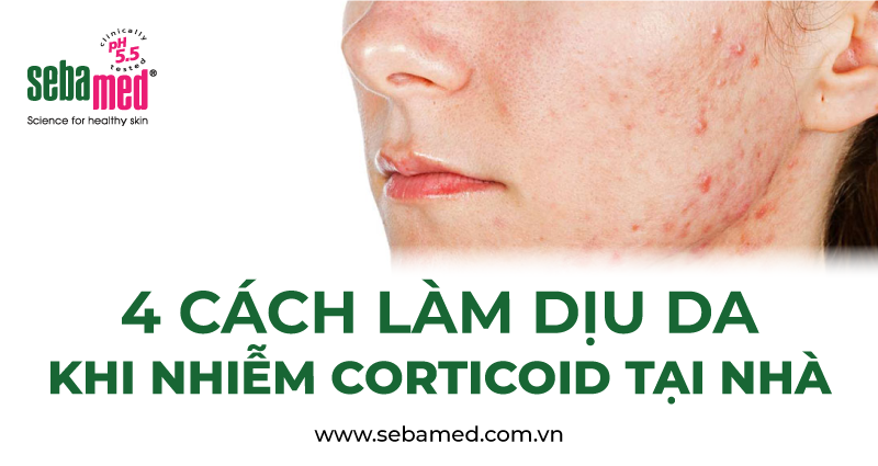 Da nhiễm corticoid