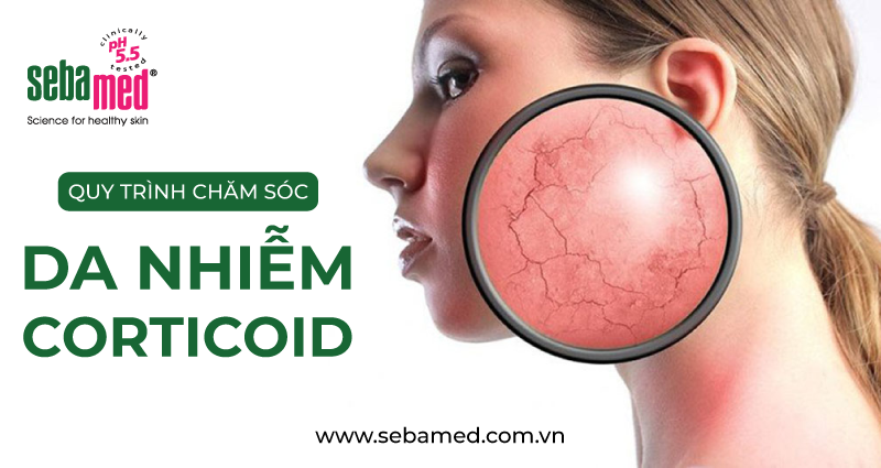 Da nhiễm corticoid