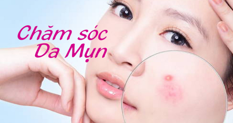 Cách trị mụn bọc hiệu quả an toàn tại nhà - sebamed Cách trị mụn bọc hiệu quả an toàn tại nhà – www.sebamed.com.vn