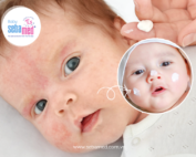 Kiểm soát bệnh Chàm da bằng cách dưỡng ẩm