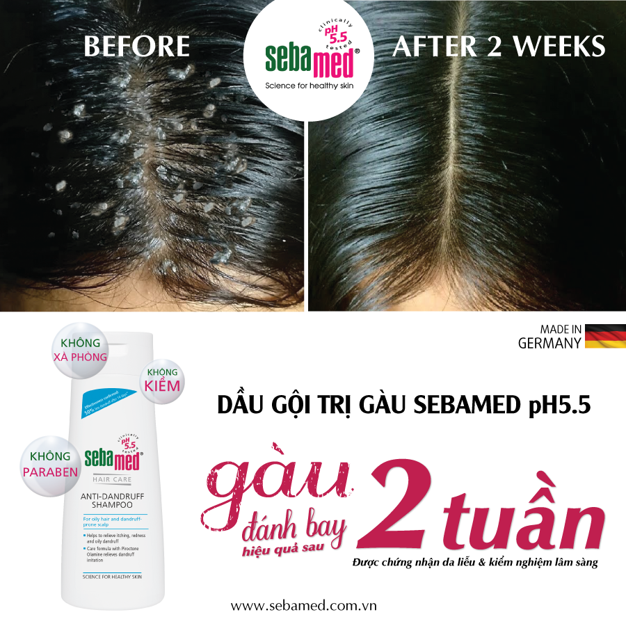 before after dau goi tri gau sebamed pH5 5 1 - 3
