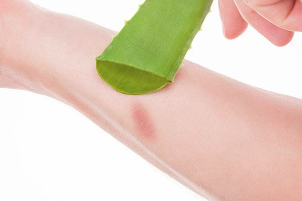 Chiết xuất lô hội aloe vera trong mỹ phẩm có tác dụng gì cho da? - 9 - sebamed Gel nha đam giúp làm dịu vết bỏng và phục hồi hàng rào bảo vệ da