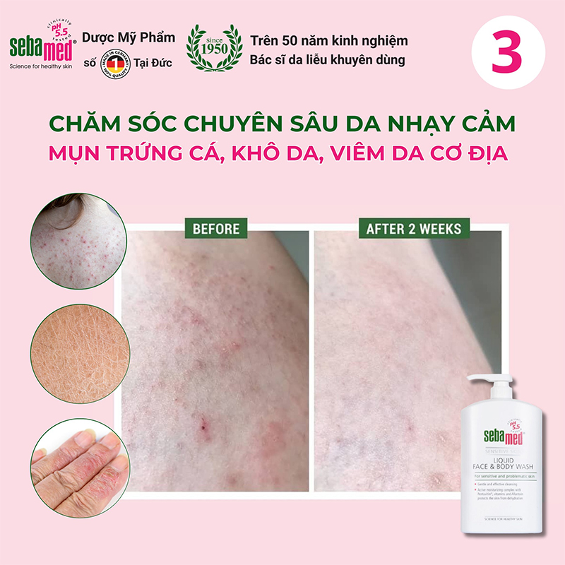 Sử dụng Sữa rửa mặt và sữa tắm toàn thân giúp da mềm mịn, phù hợp với da kích ứng, nhạy cảm.
